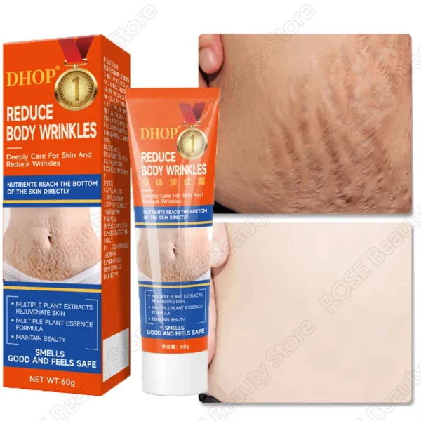 PWYUMAN Stretch Marks Removal Cream for Pregnant Women